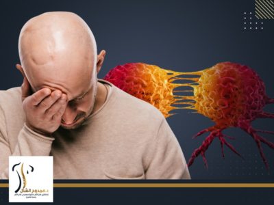 علاج الاورام السرطانية (علاج آلام الأورام السرطانية )