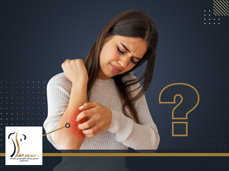 اسباب الحزام الناري