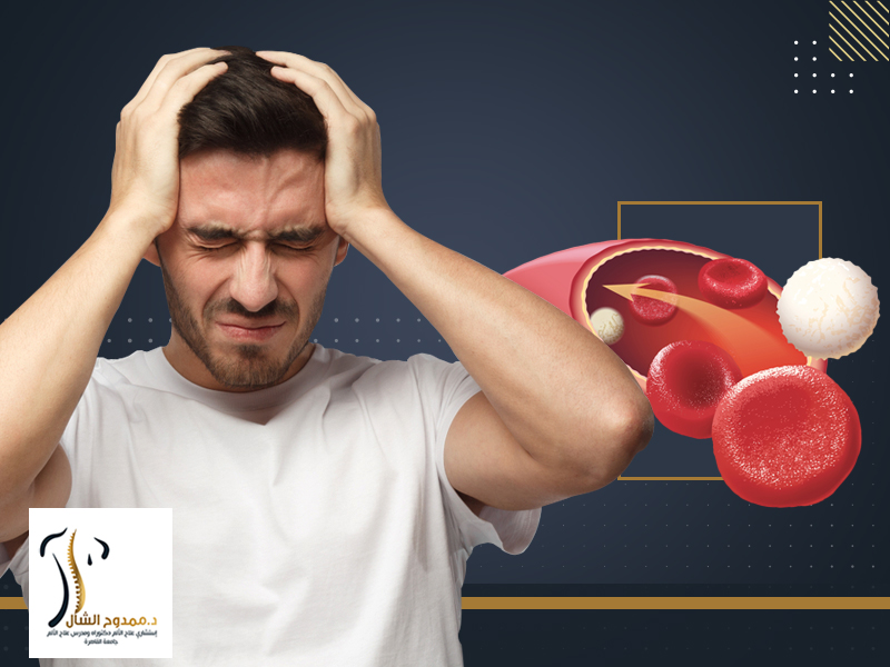 علاج ضعف الدورة الدموية