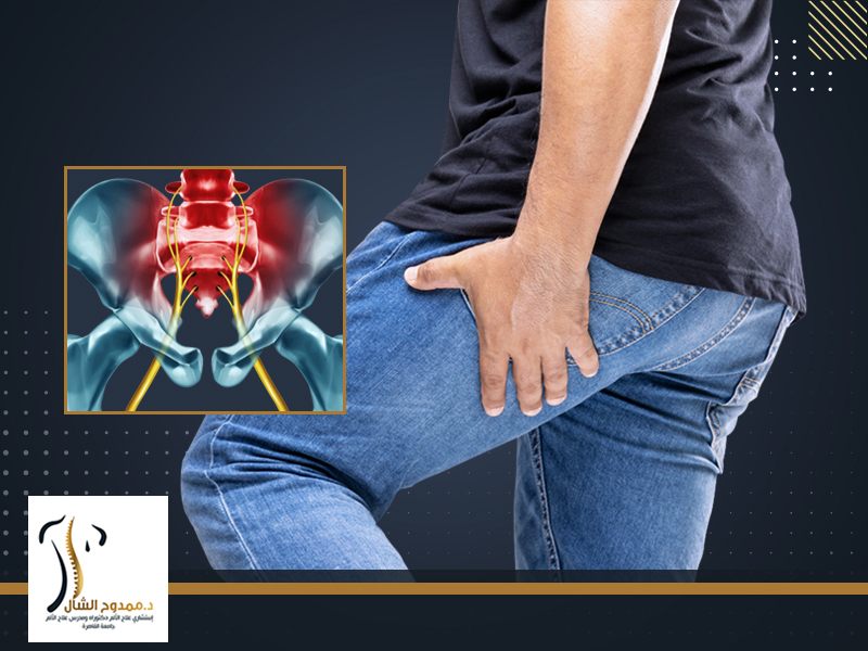 اعراض عرق النسا في الرجل اليسرى