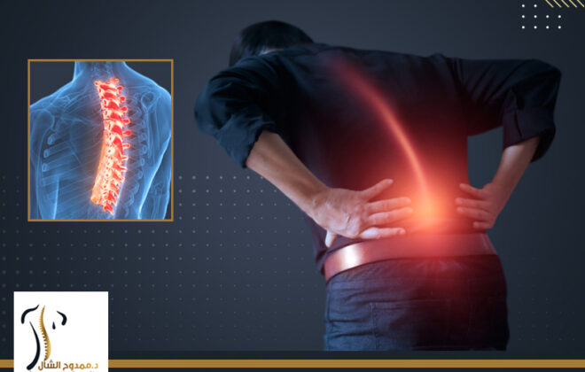 ألم شديد بعد عملية الغضروف